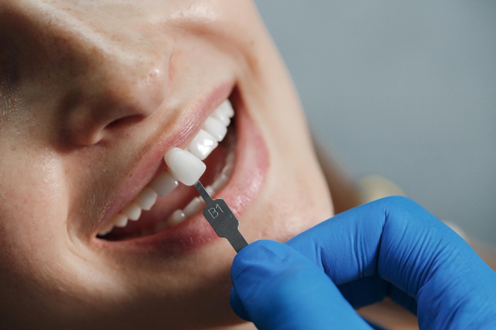 How Dental Implants Work to Replace Missing Teeth: A Complete Guide for Patients in Dubai